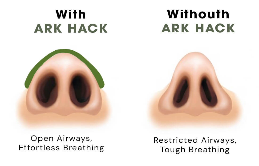 ARK Drops + ARK Hack Bundle – ARK Of Sweden